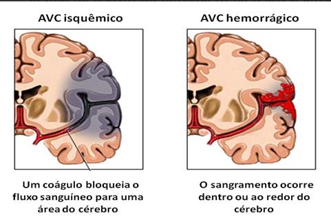 Detalhamento da região cerebral 
