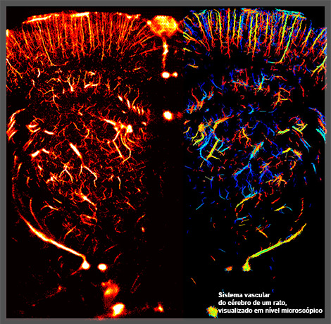 Sistema vascular do cérebro de um rato, visualizado em nível microscópico