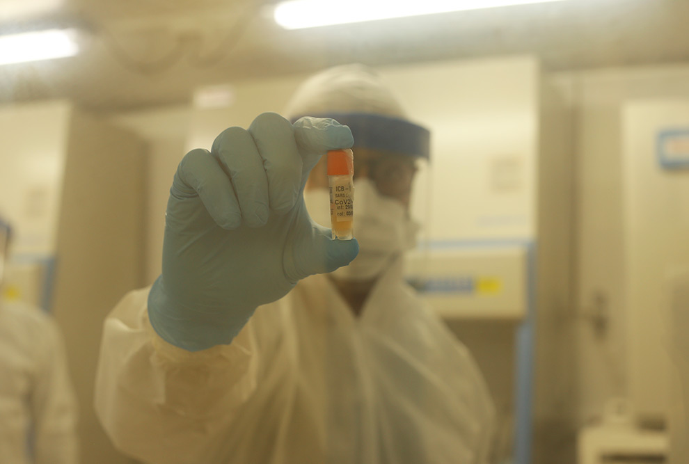Amostra do coronavírus do primeiro paciente infectado no Brasil; pesquisadores iniciando a primeira etapa para o desenvolvimento de teste de diagnóstico