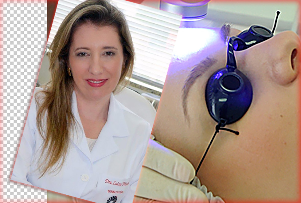 Luiza Pitassi conta que o laser ajuda a distribuir medicamento na pele