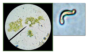 A alga Pseudokirchneriella subcapitata: distribuição cosmopolita (Foto: Divulgação)