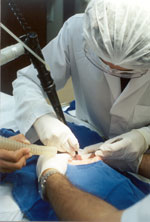 Procedimento na Medicina Laser da Unicamp: cirurgia minimanente invasiva
