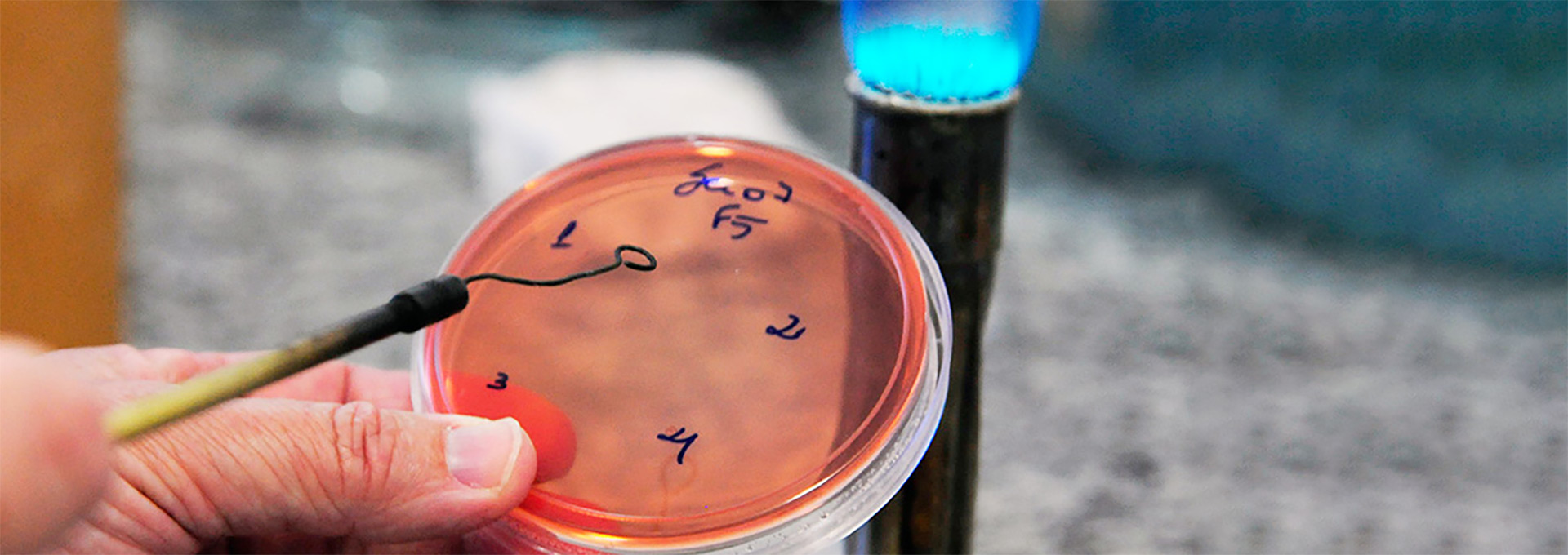 Cultura da bactéria Shigella sonnei em laboratório no Instituto de Biologia