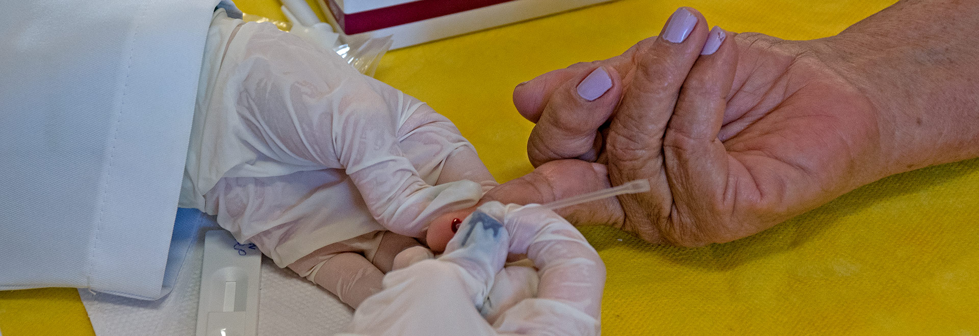 Camundongos obesos tratados com o 12-HEPE, substância produzida pelo tecido adiposo marrom em baixas temperaturas, conseguiram controlar de forma mais eficaz a glicemia sanguínea quando desafiados com uma sobrecarga de açúcar | Foto: Antoninho Perri 