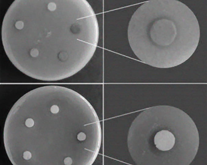 Atividade antimicrobiana do AgVO3 decorado com nanopartículas de prata em diferentes concentrações contra diferentes microrganismos. (Imagem Scientific Report-Nature) Atividade antimicrobiana do AgVO3 decorado com nanopartículas de prata em diferentes concentrações contra diferentes microrganismos. (Imagem Scientific Report-Nature)
