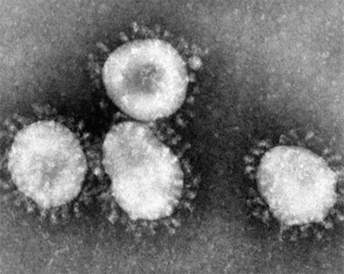 Maior nível de glicose no sangue é captado por células de defesa e serve como fonte de energia que permite ao vírus se replicar mais, desencadeando resposta imunológica que mata células pulmonares e desregula sistema imune (imagem: Wikimedia Commons) Maior nível de glicose no sangue é captado por células de defesa e serve como fonte de energia que permite ao vírus se replicar mais, desencadeando resposta imunológica que mata células pulmonares e desregula sistema imune (imagem: Wikimedia Commons)