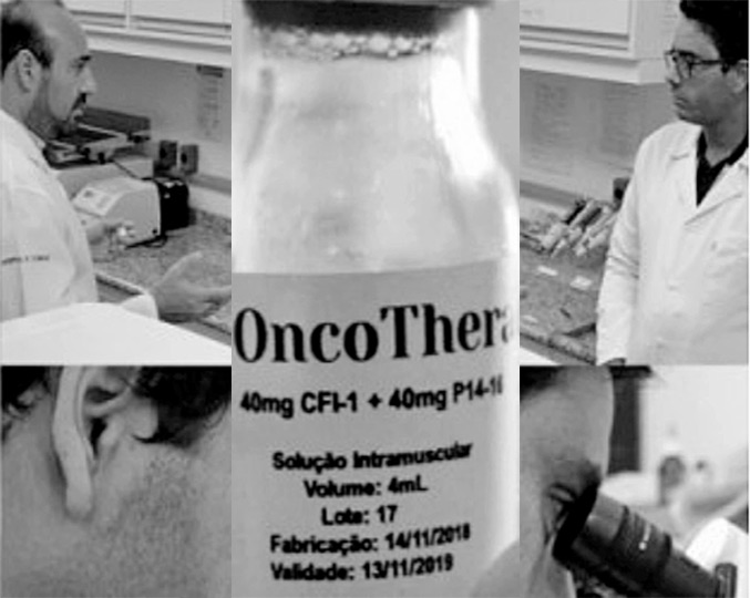 Imunoterápico brasileiro foi testado por pesquisadores da Unicamp em cinco pacientes que contraíram o novo coronavírus enquanto lutavam contra tumores na bexiga. Tratamento amenizou a inflamação no pulmão e encurtou a internação (imagem: divulgação) Imunoterápico brasileiro foi testado por pesquisadores da Unicamp em cinco pacientes que contraíram o novo coronavírus enquanto lutavam contra tumores na bexiga. Tratamento amenizou a inflamação no pulmão e encurtou a internação (imagem: divulgação)