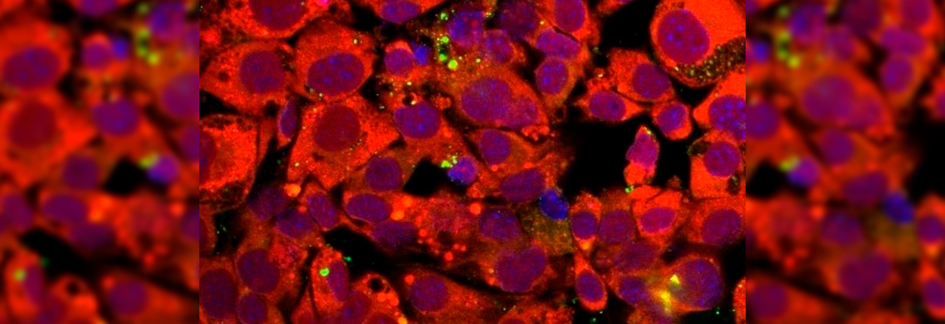 Os experimentos com adipócitos humanos estão sendo conduzidos in vitro no Laboratório de Estudos de Vírus Emergentes (Leve) Imagem de microscópia de fluorescência de adipócitos