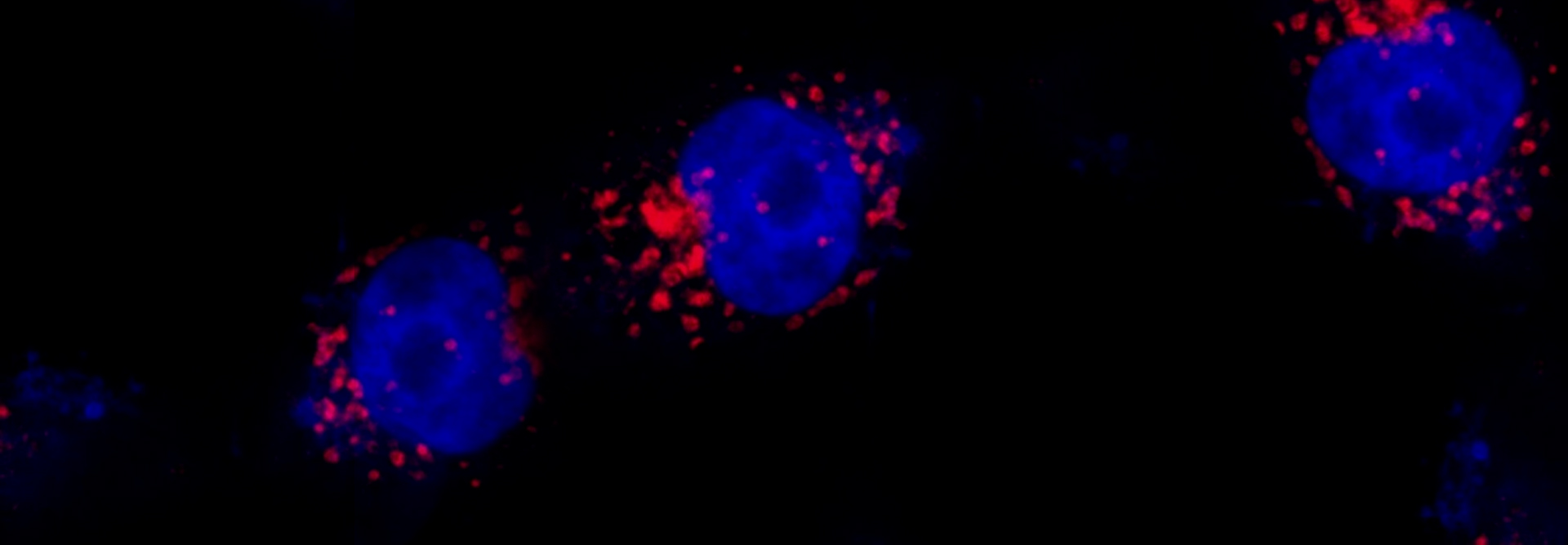 Imagem microscópica do microorganismo replicando na periferia do núcleo da célula