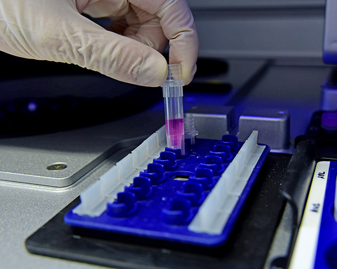 foto mostra mão manuseando ampolas em laboratório