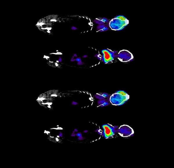 Experimento de captação de glicose com tomografia computadorizada por emissão de pósitrons. A cor vermelha indica maior captação da glicose Experimento de captação de glicose com tomografia computadorizada por emissão de pósitrons. A cor vermelha indica maior captação da glicose