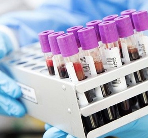 Método desenvolvido pela Unicamp e Unifesp possibilita diagnóstico pela análise de metabólitos em amostras sanguíneas