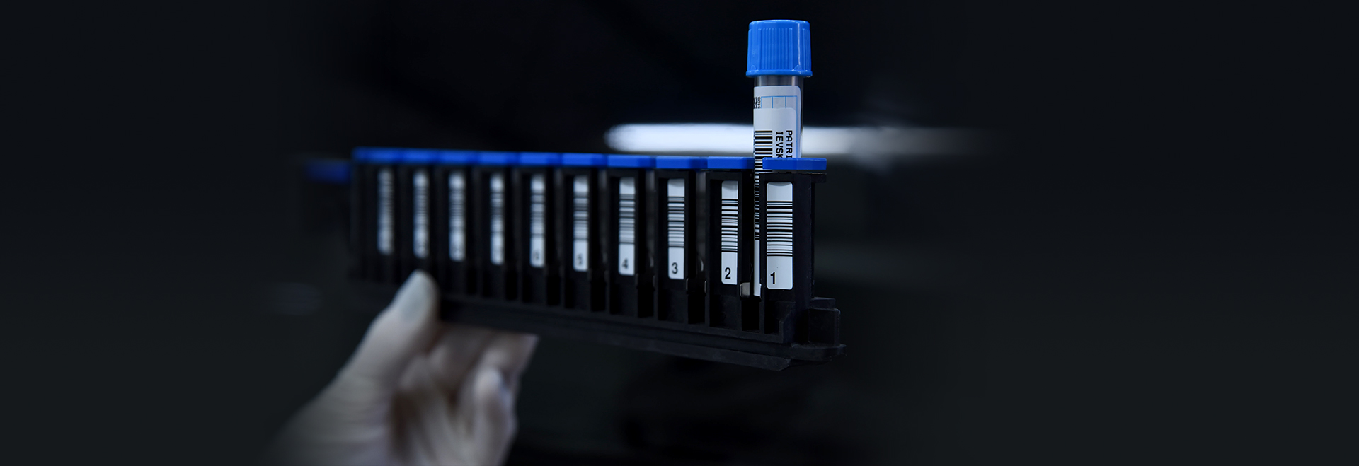 O estudo terá duração de cinco anos e fará o levantamento de dados prospectivos dos pacientes por um período de até 24 meses Audiodescrição. Foto: Antonio Scarpinetti. Em um laboratório de pesquisas, imagem close-up e em perspectiva de 11 pequenos tubos plásticos com tampas azuis que contêm material e etiquetas com código de barra coladas na lateral. Os tubos estão encaixados em um dispositivo de modo que permanecem alinhados um ao lado do outro. Uma pessoa que usa luvas de silicone brancas segura todo esse conjunto com a mão esquerda. O ambiente ao redor e ao fundo da imagem é totalmente escuro. Imagem 1 de 1.