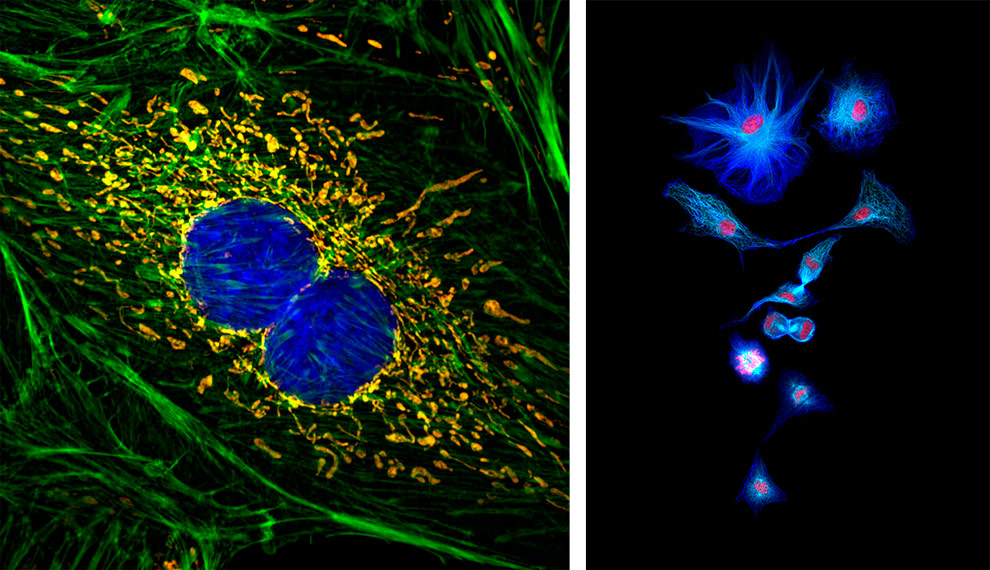 Composição com duas fotos de células obtidas por microscópio