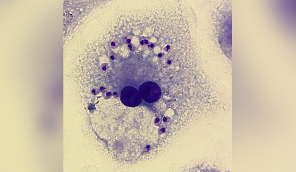 Macrófago infectado com o protozoário causador da leishmaniose, doença tropical negligenciada estudada pelo grupo do Lebil