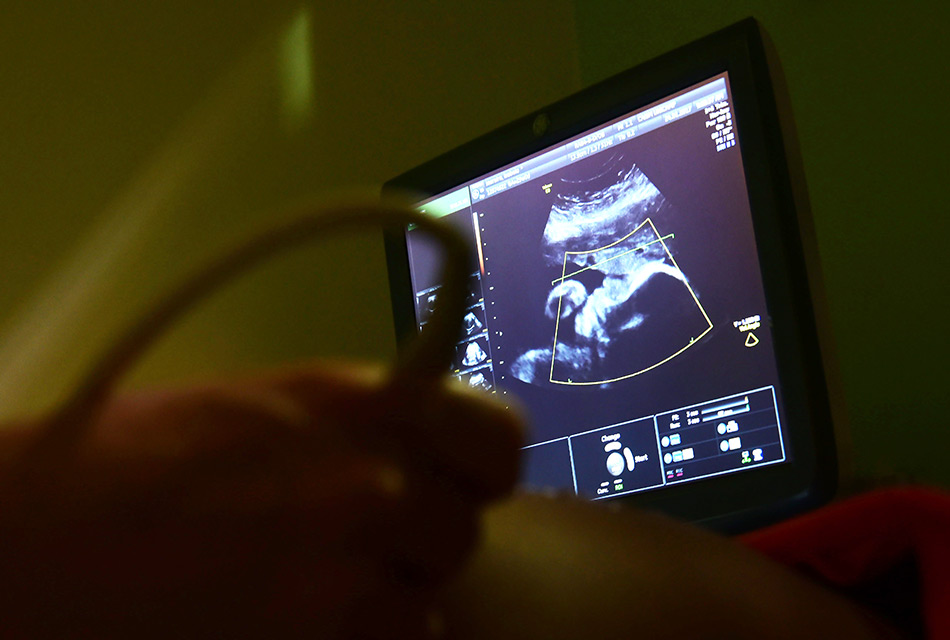 Médico passa sensor de equipamento de ultrassonografia sobre o ventre de gestante, enquanto examina imagem na tela