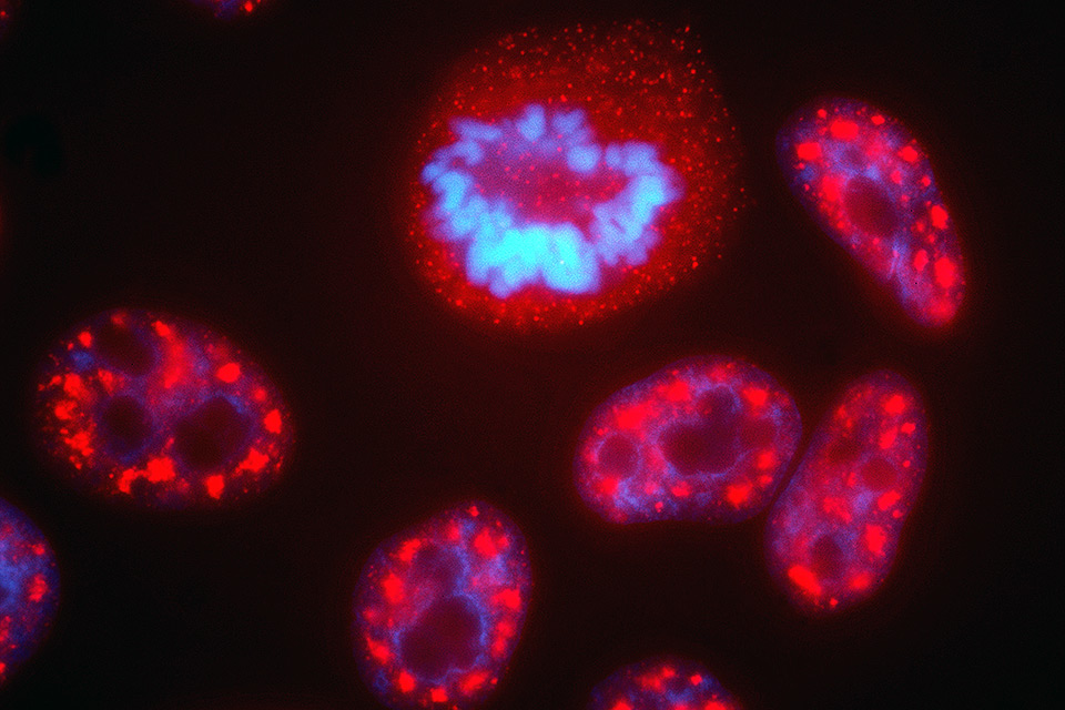 Núcleos de células humanas; a estrutura destacada em azul são os cromossomos 