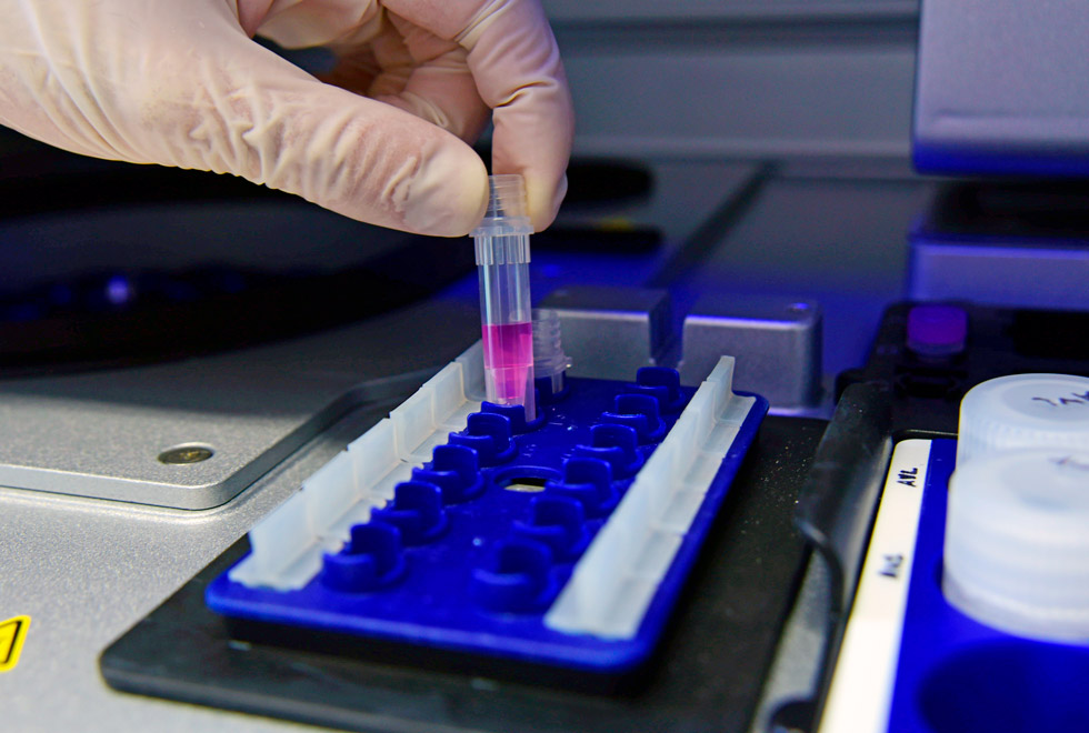 audiodescrição: fotografia colorida de um frasco contendo líquido de cultivo de microrganismos