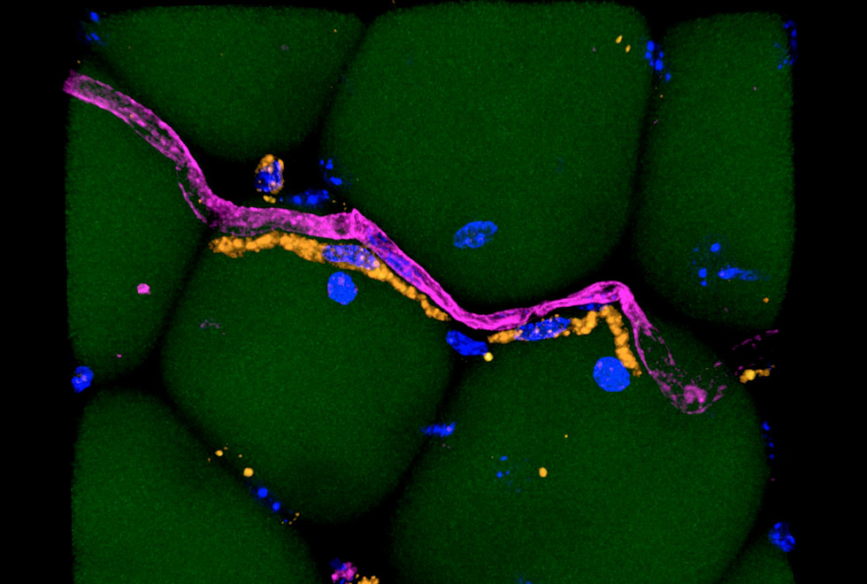 imagem de microscópio mostra células do tecido adiposo e células de defesa do organismo