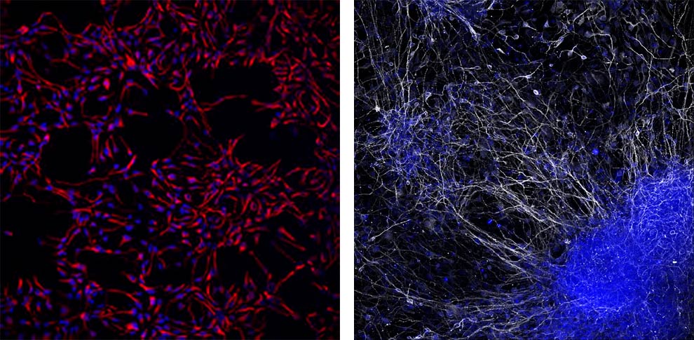 À esquerda, imagem de células neuroprogenitoras; à direita, imagem de neurônios diferenciados. Crédito: Mario Bengtson