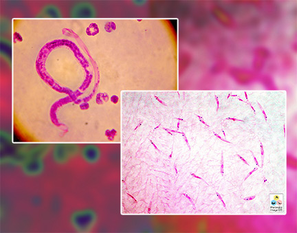 Imagem microscópica da Leishmania spp. e Brugia Malayi : vermes que provocam a leishmaniose cutânea e a elefantíase (filariose linfática) Imagem microscópica da Leishmania spp. e Brugia Malayi