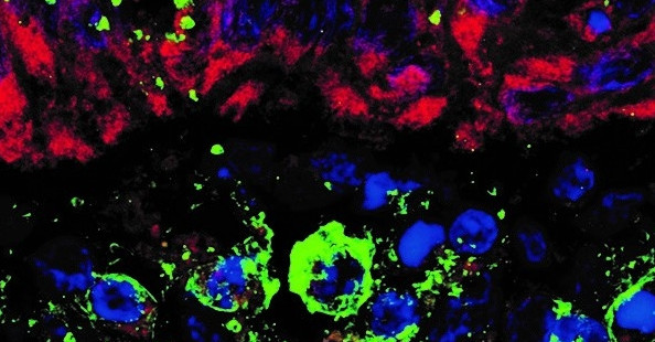 Biópsias intestinais infectadas com SARS-CoV-2. Os núcleos das células estão marcadas em azul Biópsias intestinais infectadas com SARS-CoV-2. Os núcleos das células estão marcadas em azul
