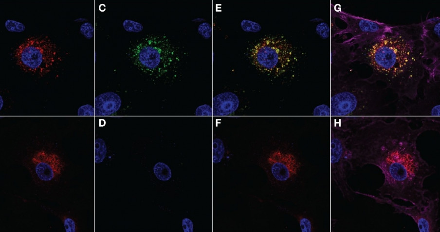 Células Vero infectadas com a linhagem B do SARS-CoV-2 originalmente descrita no Brasil (imagens superiores) ou com a variante P.1. 