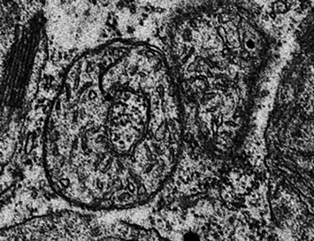A imagem de microscopia eletrônica da folha de tabaco que superexpressam a UPC1 mostram mitocôndrias em formato de "donut", uma adaptação a níveis reduzidos de oxigênio intracelular. Foto: Divulgação GCCRC