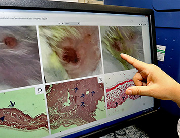 O dispositivo aplicado reduziu em até 100% os carcinomas de células escamosas em testes de laboratório. Nova terapia, que pode ser uma alternativa a tratamentos de alto custo e cirurgias, aguarda parcerias para testes clínicos. O dispositivo aplicado reduziu em até 100% os carcinomas de células escamosas em testes de laboratório. Nova terapia, que pode ser uma alternativa a tratamentos de alto custo e cirurgias, aguarda parcerias para testes clínicos.