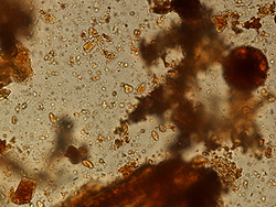 Imagem do método convencional Lutz/Hoffman, com um cisto de Giardia intestinalis 