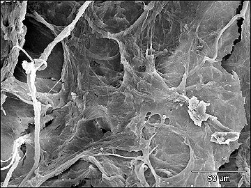 Imagem microscópica : superfície da membrana porosa de fibroína de seda, que facilita o depósito e o crescimento de células (Foto: Divulgação)