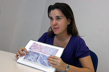 A biÃ³loga CÃ¡ssia Maria Toledo Saccon: picada causa hemorragia, necrose, dor e inchaÃ§o   ( Foto: Antoninho Perri)