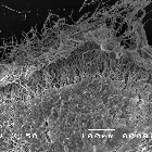 Imagem da borda do micélio (150X). (Foto: Divulgação)