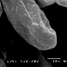  Imagem da região apical da hifa que será analisada no BCT®(20.000X).(Foto: Divulgação)